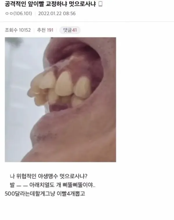 교정갤에 올라온 ㄹㅈㄷ
